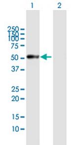 PRSS35 Antibody in Western Blot (WB)