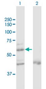 ZNF92 Polyclonal Antibody, MaxPab™