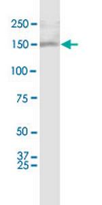 ASXL1 Monoclonal Antibody (6E2)