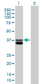CLYBL Antibody in Western Blot (WB)