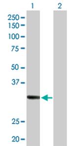 RDHE2 Polyclonal Antibody, MaxPab™