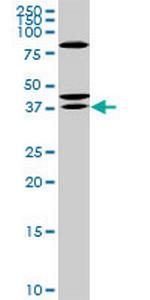 RDHE2 Monoclonal Antibody (3G8)