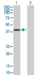 CCDC131 Polyclonal Antibody, MaxPab™
