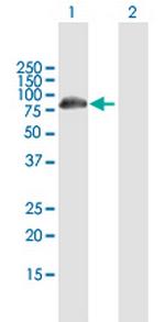 DCP1B Antibody in Western Blot (WB)