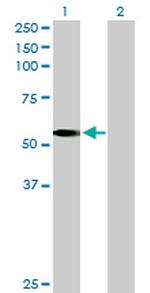 LDHD Polyclonal Antibody, MaxPab™