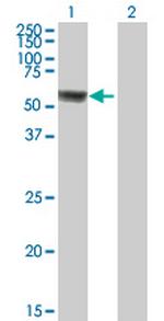 ACSF3 Polyclonal Antibody, MaxPab™