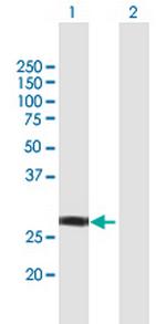 NSMCE1 Polyclonal Antibody, MaxPab™
