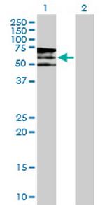 PIP5K3 Polyclonal Antibody, MaxPab™