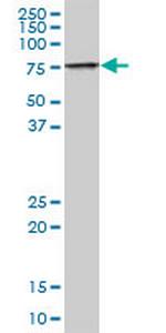 TIGD1 Antibody in Western Blot (WB)
