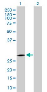 KCTD6 Polyclonal Antibody, MaxPab™