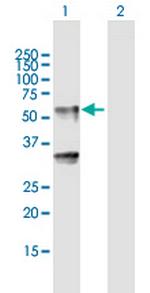 LIPH Polyclonal Antibody, MaxPab™