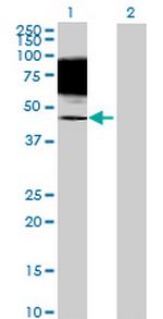 TIGD4 Polyclonal Antibody, MaxPab™
