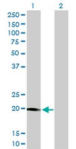 STK32A Antibody in Western Blot (WB)