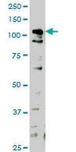 HIPK1 Monoclonal Antibody (1F2)