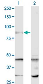 SENP5 Monoclonal Antibody (3C2)