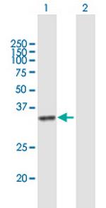 DHRSX Polyclonal Antibody, MaxPab™