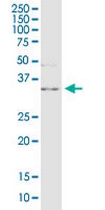 C10orf63 Monoclonal Antibody (2F10)