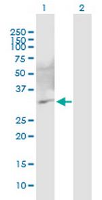 C10orf63 Monoclonal Antibody (2A7)