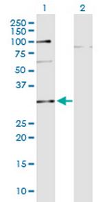 C10orf63 Monoclonal Antibody (3E8)