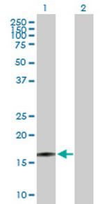 RTKN2 Antibody in Western Blot (WB)