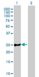 MRPL21 Antibody in Western Blot (WB)