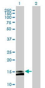 MS4A15 Antibody in Western Blot (WB)