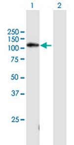 C11orf82 Polyclonal Antibody, MaxPab™