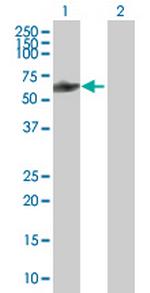 CCDC11 Antibody in Western Blot (WB)