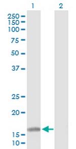 ATOH7 Antibody in Western Blot (WB)