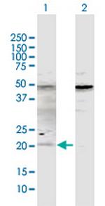 ATOH7 Antibody in Western Blot (WB)