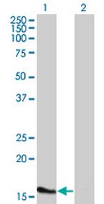 ATOH7 Monoclonal Antibody (1E5)