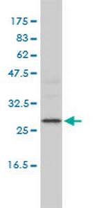 DEPC-1 Monoclonal Antibody (2A5-4F5)