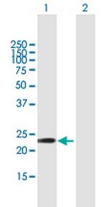 GSTA5 Polyclonal Antibody, MaxPab™