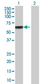 ZBTB9 Polyclonal Antibody, MaxPab™