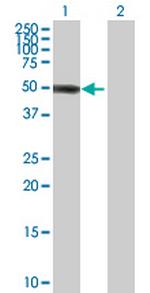 ZBTB12 Polyclonal Antibody, MaxPab™