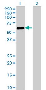 ZNF498 Antibody in Western Blot (WB)