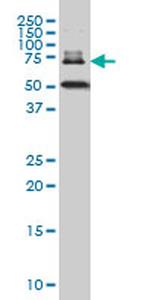DKFZP727G131 Antibody in Western Blot (WB)