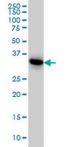 PRPS1L1 Monoclonal Antibody (5E10)