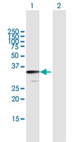 JAZF1 Polyclonal Antibody, MaxPab™