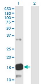 ATXN7L1 Monoclonal Antibody (1H2)