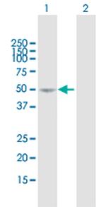 SEMA3D Antibody in Western Blot (WB)