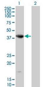 NEIL2 Monoclonal Antibody (1B7)