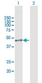 IPMK Polyclonal Antibody, MaxPab™
