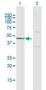 IPMK Polyclonal Antibody, MaxPab™