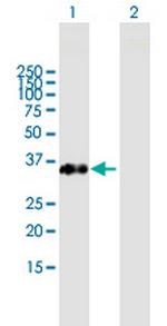FAM21C Antibody in Western Blot (WB)