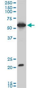 EBF3 Monoclonal Antibody (1G3)