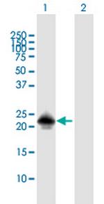 MSRB3 Polyclonal Antibody, MaxPab™