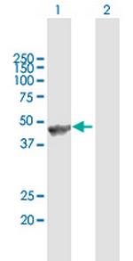 ANGPTL5 Polyclonal Antibody, MaxPab™