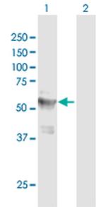 LPCAT4 Polyclonal Antibody, MaxPab™