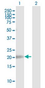 MPV17L Polyclonal Antibody, MaxPab™